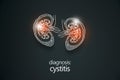 Handrawn medical poster of human kidneys organ with cystitis. Diseases of the genitourinary system. Royalty Free Stock Photo