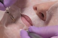 Close-up. The hands of a cosmetologist in lilac gloves hold the electrodes on a woman`s chin. Microcurrent facial massage. Health