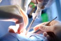 The hands of the dentist and the assistant in protective gloves with the instrument