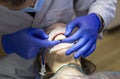 Hands of a dentist who extends the child`s front teeth. The work of a dental technician Royalty Free Stock Photo