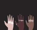 Hands with dermatological Vitiligo disease are raised up and place for text as a unity concept, flat vectorana glass art Royalty Free Stock Photo