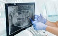 Hands doctor dentist in gloves show the teeth on x-ray on digital screen in dental clinic on light background with medical