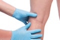 hands of doctor in gloves and leg with dilated veins close up on white