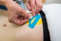 The hands of a female physiotherapist apply adhesive elastic therapeutic tape to the female abdominal muscle of a young adult slim