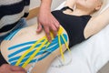 The hands of a female physiotherapist apply adhesive elastic therapeutic tape to the female abdominal muscle of a young adult slim
