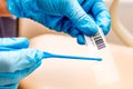 Hands of a gynecologist close-up while applying a smear on the glass. Gynecological analysis