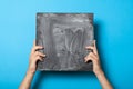 Hands holding chalkboard mockup. Advertisement background. Art frame blank. Creative canvas Royalty Free Stock Photo