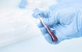 hands of a lab technician with a tube of blood sample / lab assistant holds a blood test tube for research.