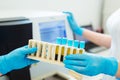 Hands of laboratory assistant loading sample tubes for coagulation test analysis and inputing data to coagulation