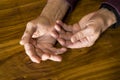 The hands of a male with Psoriatic Arthritis