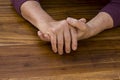 The hands of a male with Psoriatic Arthritis Royalty Free Stock Photo