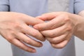 Hands of men suffering from finger joint pain. Causes of rheumatoid arthritis, gout. Health care and medical concept