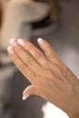 Woman hands with rheumatism arthritis and skin blemishes