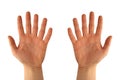 Hands with six fingers Royalty Free Stock Photo