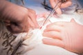 Hands of surgeon and assistant close-up during operation