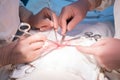 Hands of surgeon and assistant, close-up, during surgery