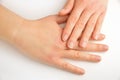 Hands touching with dry skin Royalty Free Stock Photo