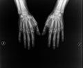Hands under X-ray Royalty Free Stock Photo