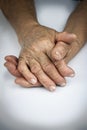 Hands Of Woman Deformed From Rheumatoid Arthritis Royalty Free Stock Photo