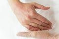 Hands of woman with skin problems Royalty Free Stock Photo