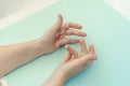 Hands of a woman with twisted fingers. Dupuytren`s contracture disease