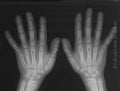 Hands x-ray Royalty Free Stock Photo