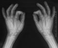 Hands x-ray Royalty Free Stock Photo