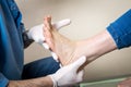 The hands of a young man doctor orthopedist conducts diagnostics, foot foot test of a woman, for the manufacture of individual, or Royalty Free Stock Photo