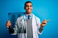 Handsome african american doctor man wearing stethoscope holding chest xray very happy pointing with hand and finger to the side Royalty Free Stock Photo