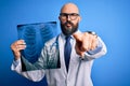 Handsome bald doctor man with beard wearing stethoscope holding chest xray pointing with finger to the camera and to you, hand Royalty Free Stock Photo