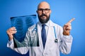 Handsome bald doctor man with beard wearing stethoscope holding chest xray very happy pointing with hand and finger to the side Royalty Free Stock Photo