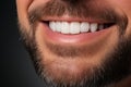 Handsome Caucasian Man with a Perfect Smile and Well-Groomed Beard on a White Background