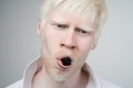 Portrait of an albino man in studio dressed t-shirt isolated on a white background. abnormal deviations. unusual appearance