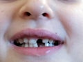 Child proud of missing front tooth Royalty Free Stock Photo