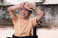 Happy face of young man with disabilities. Royalty Free Stock Photo