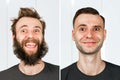 Happy guy with beard and without hair loss. Man before and after shave or transplant. haircut set transformation Royalty Free Stock Photo