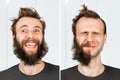 Happy guy with half beard and without hair loss. Man before and after shave or transplant. haircut set transformation Royalty Free Stock Photo