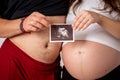 Happy married couple are showing pregnancy test stick and ultrasound picture of their unborn baby. Focus on two stripes