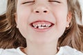 Happy smiling child portrait. Dental care, oral health. Close-up of teeth. Little todler attractive lovely sweet curious cheerful