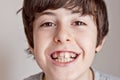 Happy teen with Braces Royalty Free Stock Photo