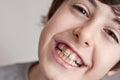 Happy teen with Braces Royalty Free Stock Photo