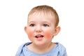 Happy toddler baby with allergies on the face, isolated on a white background. Portrait of a smiling allergic child with red Royalty Free Stock Photo