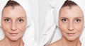 happy woman after beauty treatment - before/after shots - skin care, anti-aging procedures, rejuvenation, lifting, tightening of Royalty Free Stock Photo