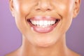 Happy woman, face or dental care on purple studio background or teeth whitening, invisible braces treatment or grooming Royalty Free Stock Photo
