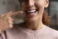 Happy young woman pointing finger at white toothy smile.