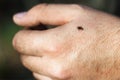 Hard-bodied tick of family Ixodidae on skin of human hand Royalty Free Stock Photo