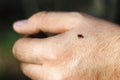 Hard-bodied tick of family Ixodidae on skin of human hand, dangerous mite Royalty Free Stock Photo