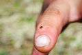 Hard mite, scale tick of family Ixodidae on human finger Royalty Free Stock Photo