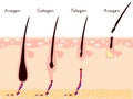 Hare care loos. life cycle of hair fall. vector illustration.