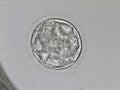 Hatched human blastocyst. Grade CB. on the fifth day of development. Microscope view Royalty Free Stock Photo